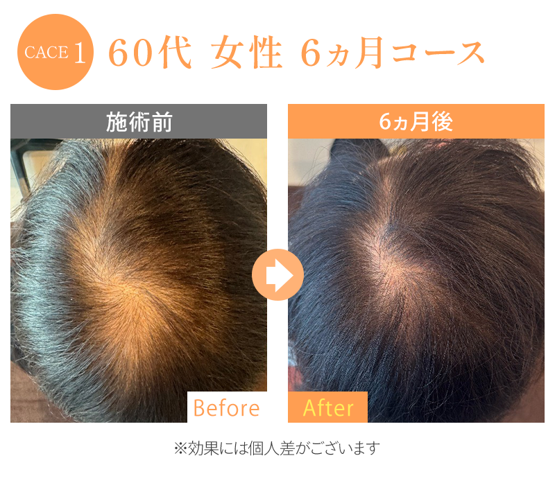 ビフォーアフター