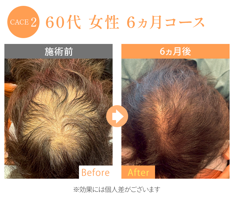 ビフォーアフター