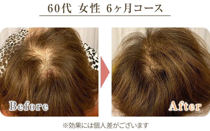 ビフォーアフター