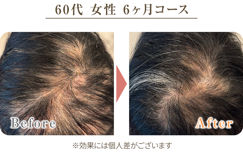 ビフォーアフター