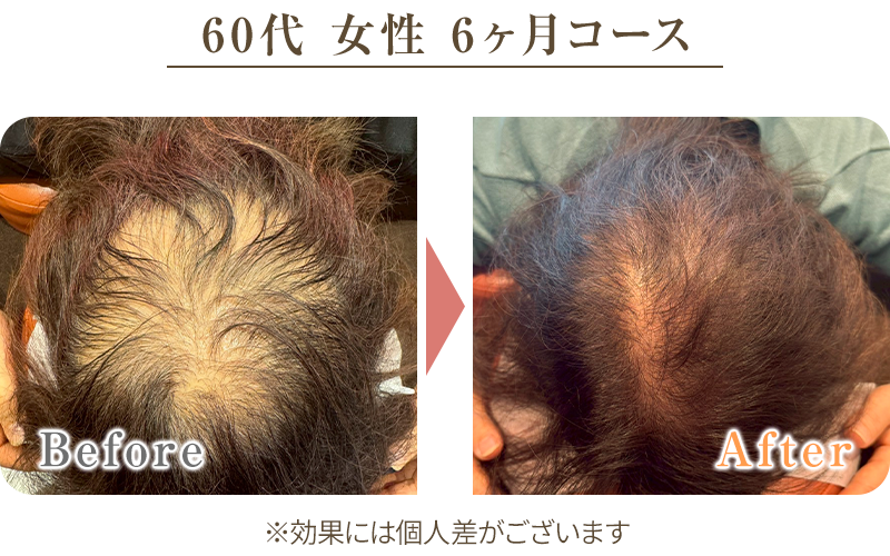 ビフォーアフター