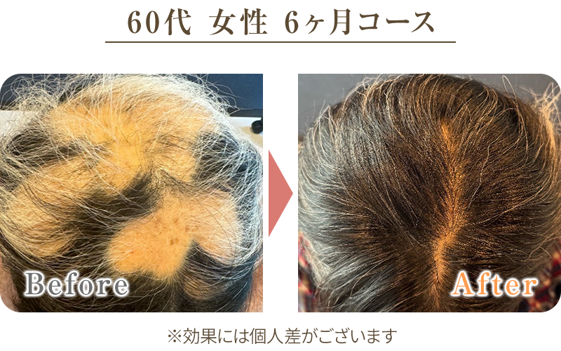 ビフォーアフター