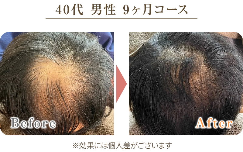 ビフォーアフター