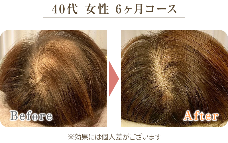 ビフォーアフター