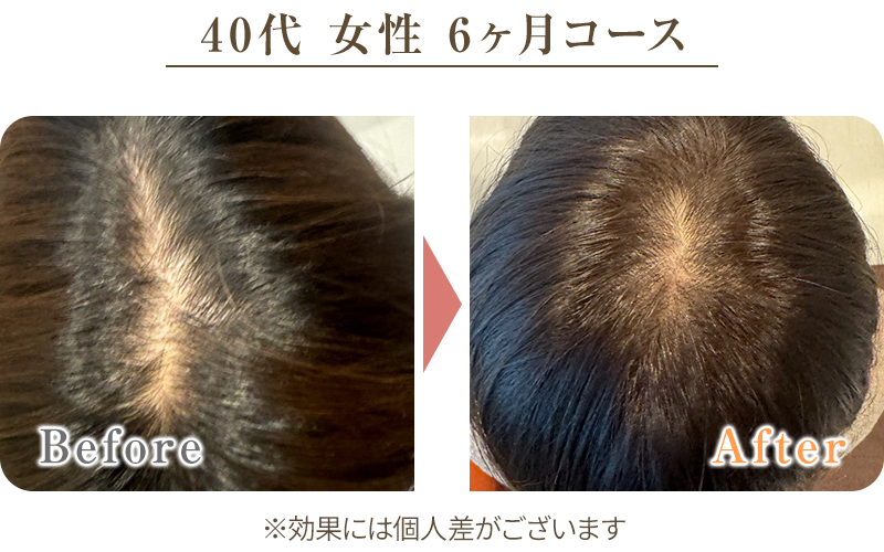 ビフォーアフター