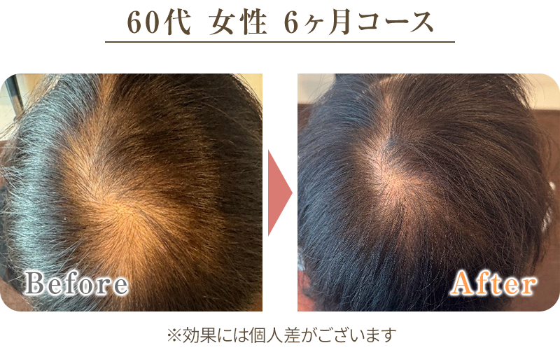 ビフォーアフター