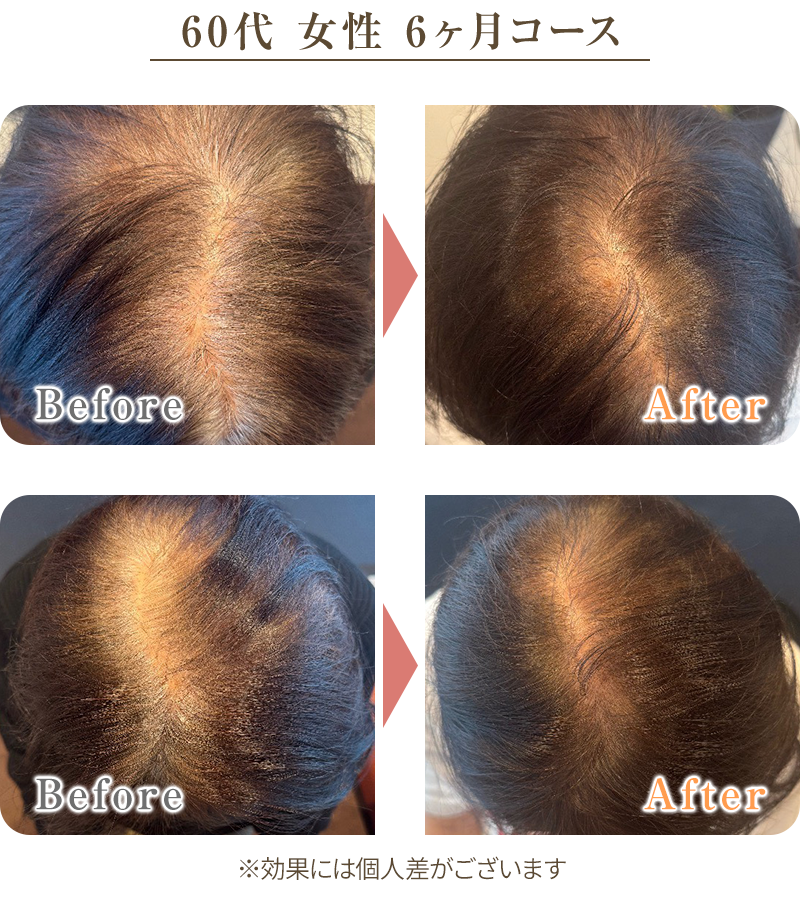 ビフォーアフター