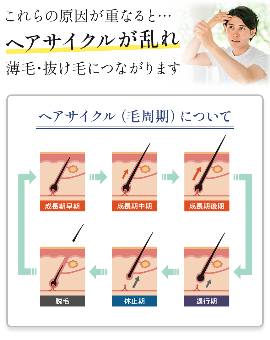 京都市河原町でAGAの改善なら「育毛・発毛促進 樹」