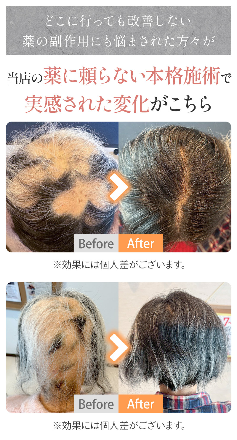 当店の薬に頼らない本格施術で実感された変化がこちら